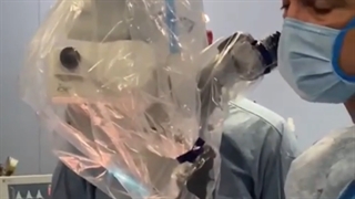 ملانومای متاستاتیک