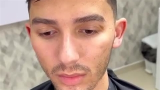 پروتز مو جلوی سر 09198858620