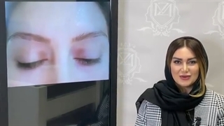 بدون عوارض در کلینیک ترانسپلنت ابرو بکارید!