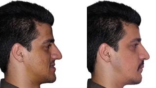 ارتودنسی و عمل فک | دکتر داودیان