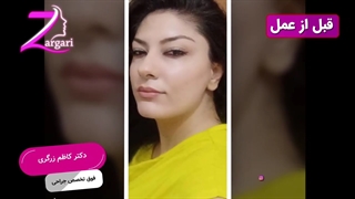قبل و بعد این عمل چطوره؟