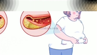 داروی گیاهی کنترل چربی خون پرنیان/۰۹۱۲۰۷۵۰۹۳۲/کنترل چربی خون.کاهش کلسترول وغلضت خون