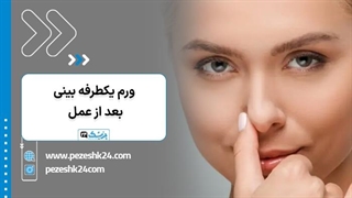 ورم بینی بعد از عمل، دلایل و درمان