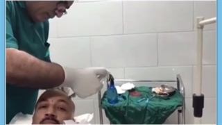 عفونت بعد از کاشت مو | علائم ، نحوه درمان با تصویر