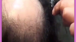 نحوه شستن موها و شامپو مناسب بعد از کاشت مو