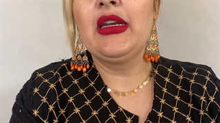 لمینت و ایمپلنت دندان (دکتر یلدا بازرگان)02122220000