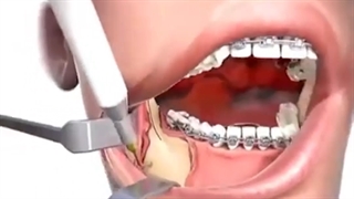 جراحی ارتوگناتیک.متخصص ارتودنسی دکترعلیرضاخدیوی