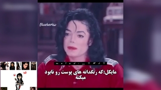 چرا مایکل جکسون آرایش میکرد؟(بیماری پوستی)