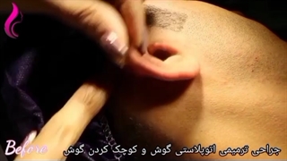 جراحی ترمیمی اتوپلاستی و کوچک کردن گوش