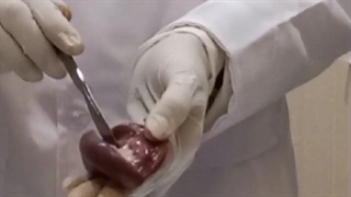 تشریح کلیه قسمت اول