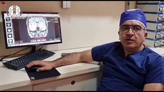 عمل جراحی تشنج مقاوم به درمان (صرع لوب تمپورال)