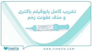 معرفی ژل ایکس پلاس phmb