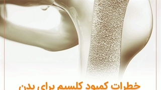 کمبود کلسیم را چگونه جبران کنیم؟ | سوپرابیون