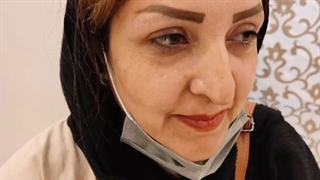 کاشت ابرو طبیعی