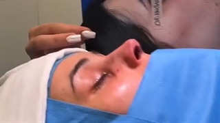 عمل بینی طبیعی زنانه