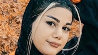 قبل و بعد از جراحی بینی