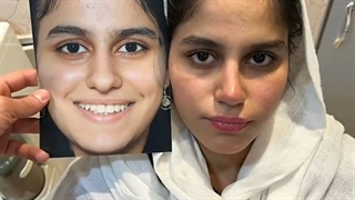 فیلم عمل بینی