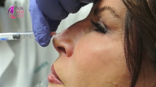 آموزش تزریق ژل بینی