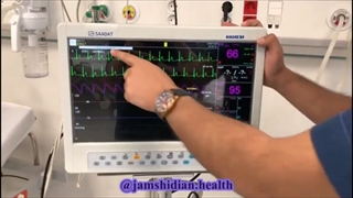 تنظیمات دستگاه مانیتورینگ | آموزش دستگاه مانیتورینگ |جمشیدیان هِلث