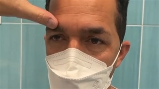 فیلم اتاق عمل و نتیجه لیفت ابرو