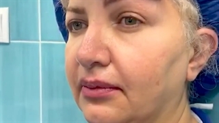 فیلم عمل لیفت ابرو