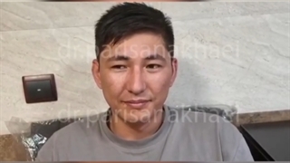 عمل لازک (PRK) بلافاصله پس از برداشتن لنز پانسمانی