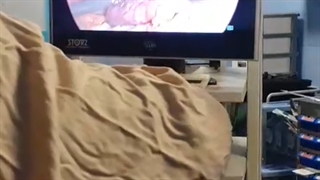 فیلم بدون سانسور از لاپاراسکوپی توده لگنی بهمراه خارج کردن رحم وتخمدانها