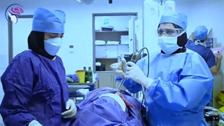 اثر روش اندوسکوپی بر عود پولیپ