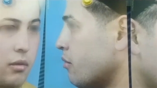 فیلم واقعی جراحی زیبایی بینی