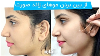 ماسک مناسب از بین بردن موهای زائد صورت | آچاره