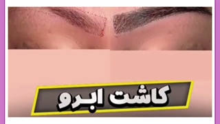 بهترین زمان اصلاح ابروها بعد از کاشت