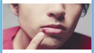 تبخال چیست و چگونه درمان می شود؟