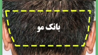 بانک مو و گرافت مو چیست؟
