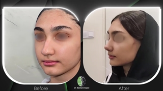 جراحی زیبایی بینی | دکتر باستانی نژاد