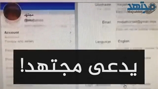 من هو مجتهد؟ پلاستیک لثه