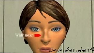 بهترین جراح بینی در تهران