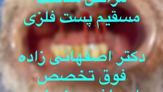 مراحل ساخت مسقیم پست فلزی