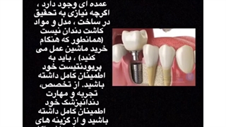 تفاوت مواد ایمپلنت