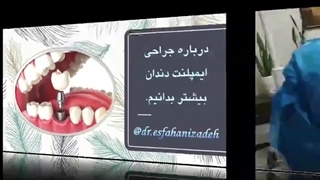 درباره ایمپلنت دندان بیشتر بدانیم