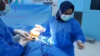 مراحل انجام ماموپلاستی