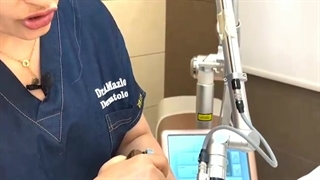 پاک کردن تاتو با لیزر در کلینیک شادی