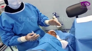 انجام عمل بلفاروپلاستی