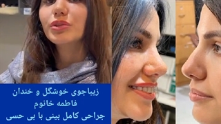 فیلم عمل بینی در مطب با بی حسی | دکتر محمدعلی حسینی در اهواز