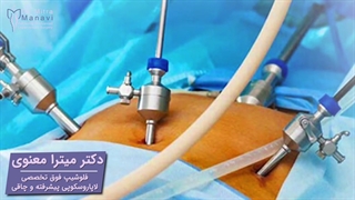 درمان فتق جدار شکم