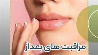 بعداز فیلر چه مراقبتهایی انجام دهیم؟