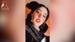 سه ماه بعد از جراحی زیبایی بینی زیبا جو