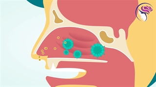 انیمیشنی در خصوص پولیپ بینی و درمان آن