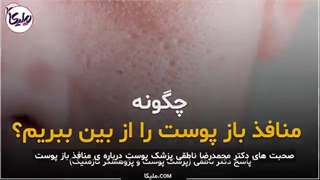 علت و درمان منافذ باز پوست رادیوگرافی دندان