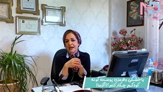 اگزما در کودکان
