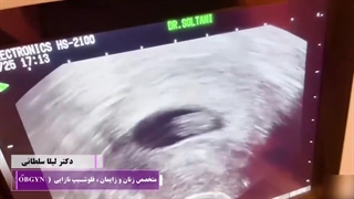 باز هم خبر خوش بارداری